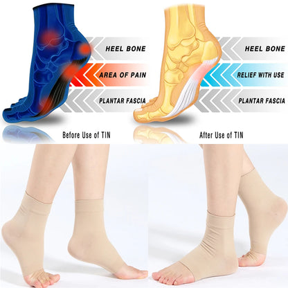 1Pair Plantar Fasciitis Socks Sleeves,30-40Mmhg Compression Socks for Ankle Support,Injury Recovery, Eases Swelling Women Men